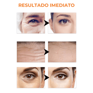 Collagen Skin Botox™ - Colágeno + Ácido Hialurônico [ATIVOS DO BOTOX] +BRINDE