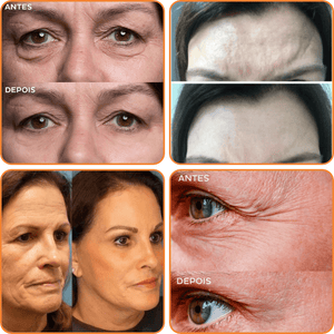 Collagen Skin Botox™ - Colágeno + Ácido Hialurônico [ATIVOS DO BOTOX] +BRINDE