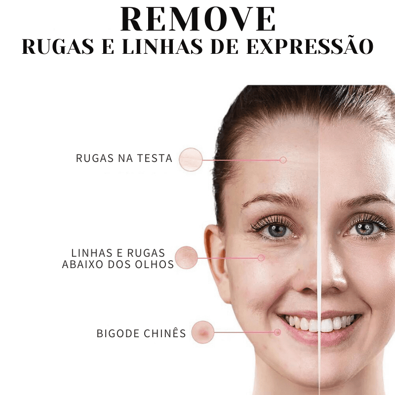 Collagen Skin Botox™ - Colágeno + Ácido Hialurônico [ATIVOS DO BOTOX] +BRINDE