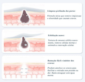 ViyaClean™  - Sérum de Limpeza Removedor de Cravos