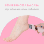 Removedor de Calos e Rachaduras dos Pés - Soft - viya-stores