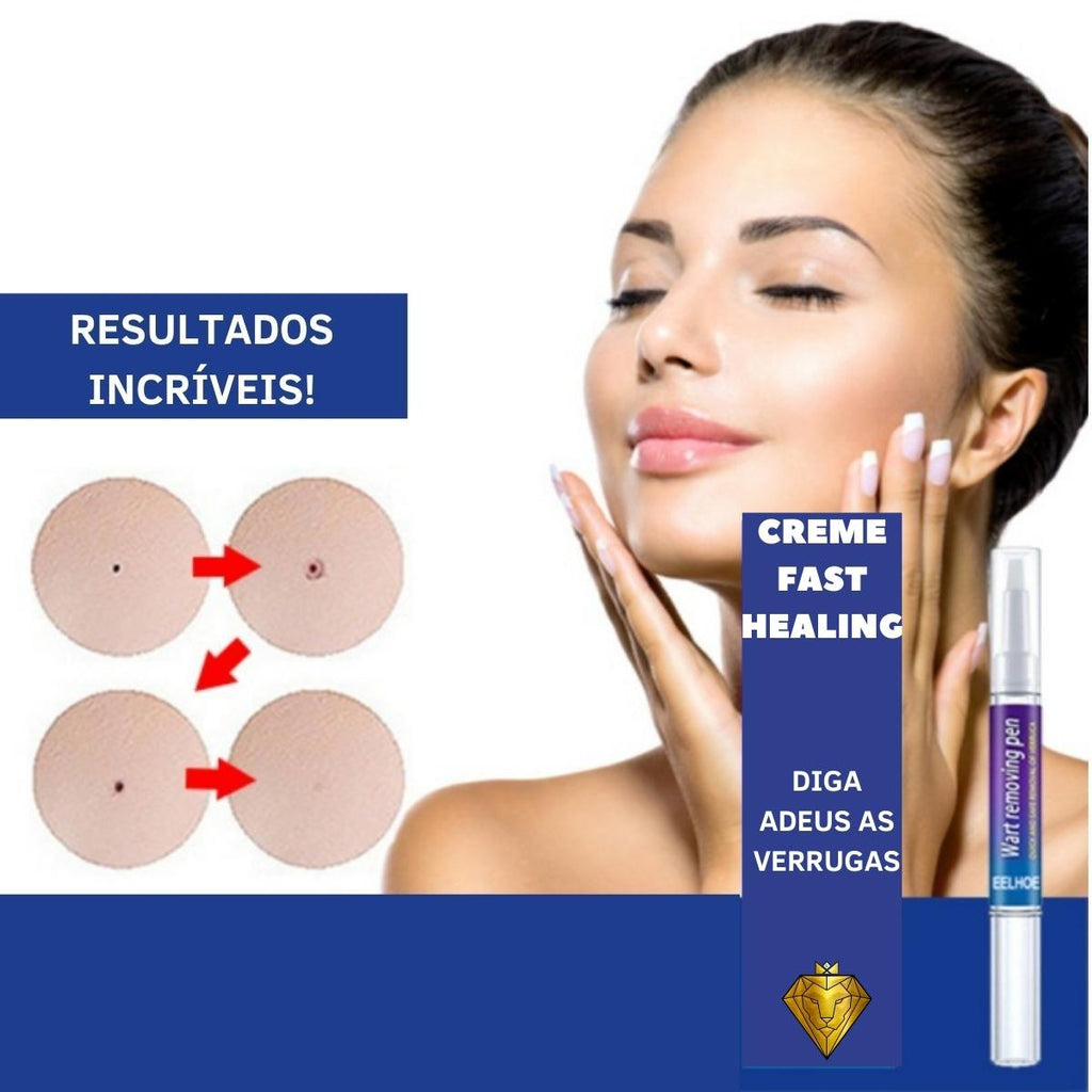 Creme Removedor de Verrugas – Fast Healing - viya-stores