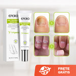 Efero Cream - Creme Anti-Inflamatório Para Remoção de Fungos - viya-stores