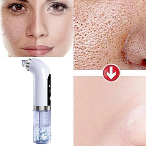Tratamento de pele - Hydro Vacuum™ - viya-stores