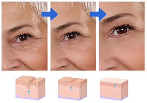 VisionLipo™ 3D - Revitaliza os Olhos 6 Em 1