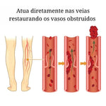 Adesivo removedor de Varizes – Varicose Veins - viya-stores