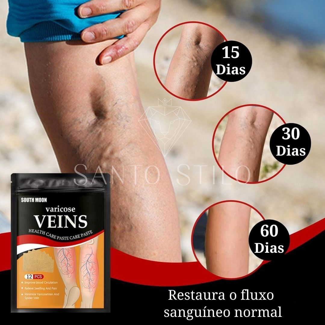 Adesivo removedor de Varizes – Varicose Veins - viya-stores