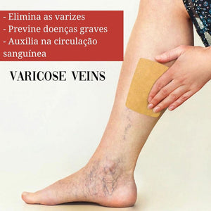 Adesivo removedor de Varizes – Varicose Veins - viya-stores