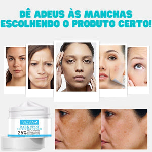 Creme para Melasma - Melaslow - viya-stores