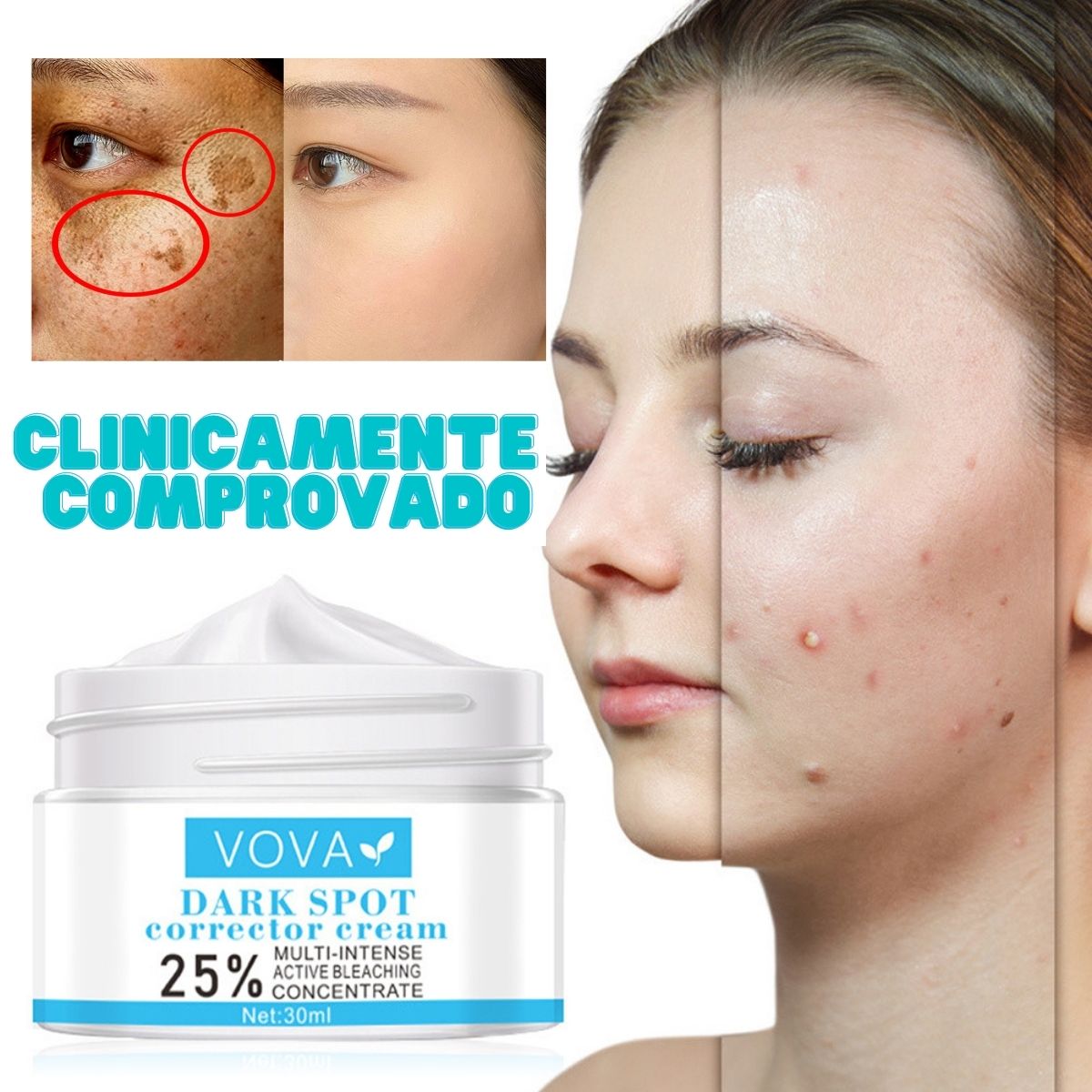 Creme para Melasma - Melaslow - viya-stores