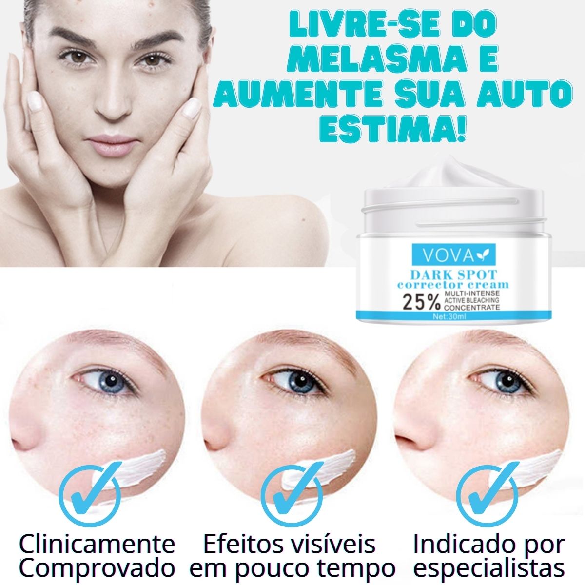 Creme para Melasma - Melaslow - viya-stores